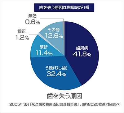 歯を失う原因